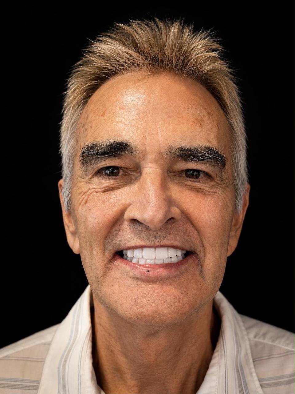 Dr. Borboa smile transformation 15